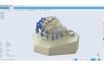 Программное обеспечение Maestro 3D Detal Studio | Ortho Studio