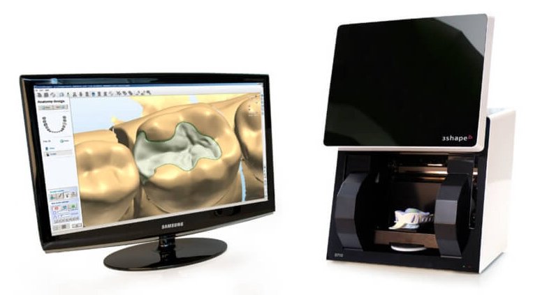 3D Сканер 3Shape D810