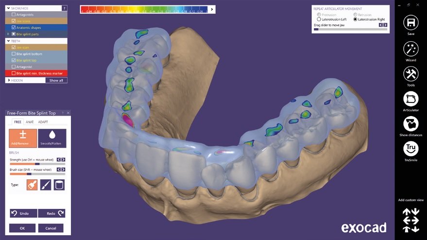Программное обеспечение Модуль Exocad Bite splint