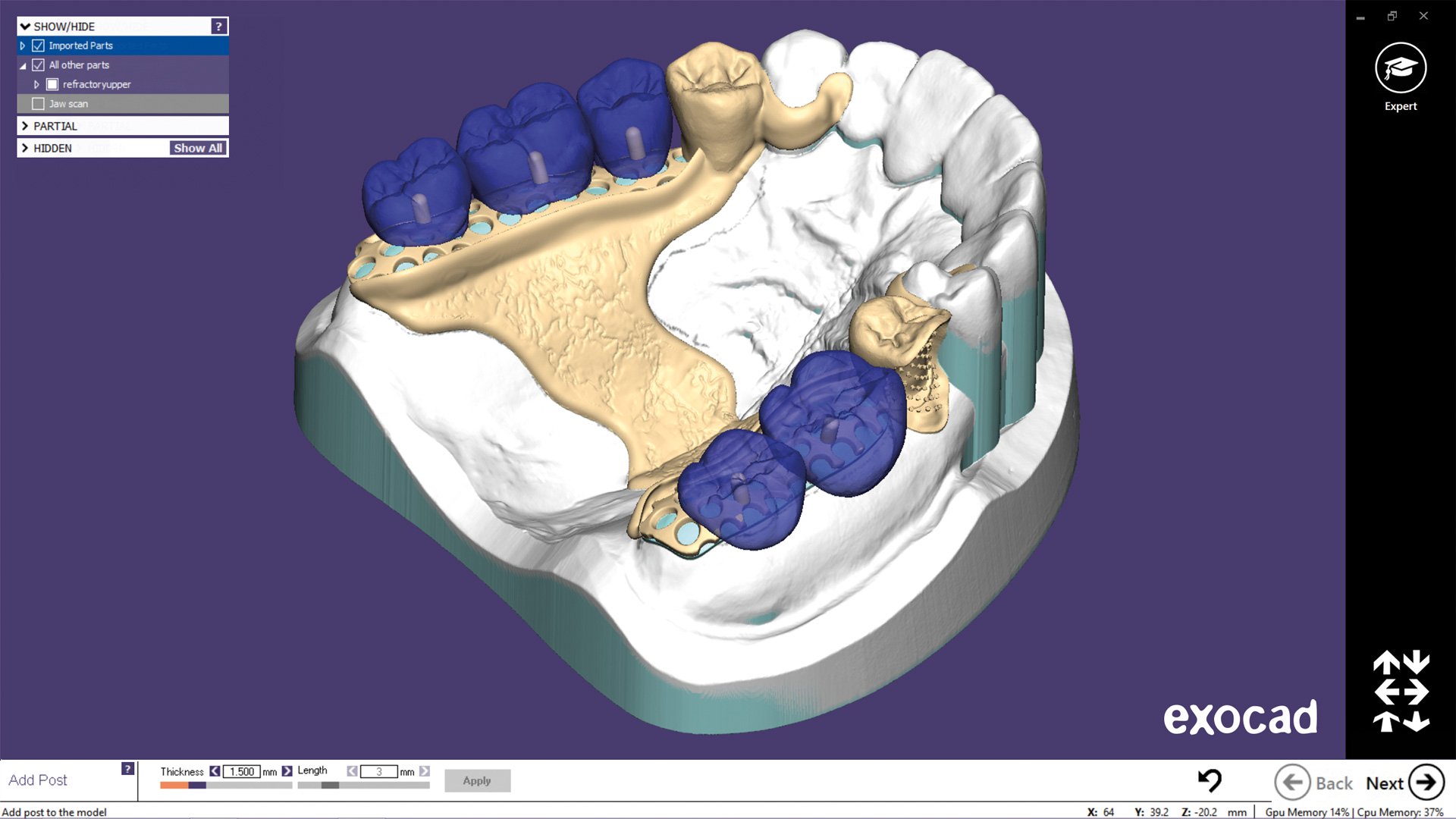 Модуль Exocad Partial Framework
