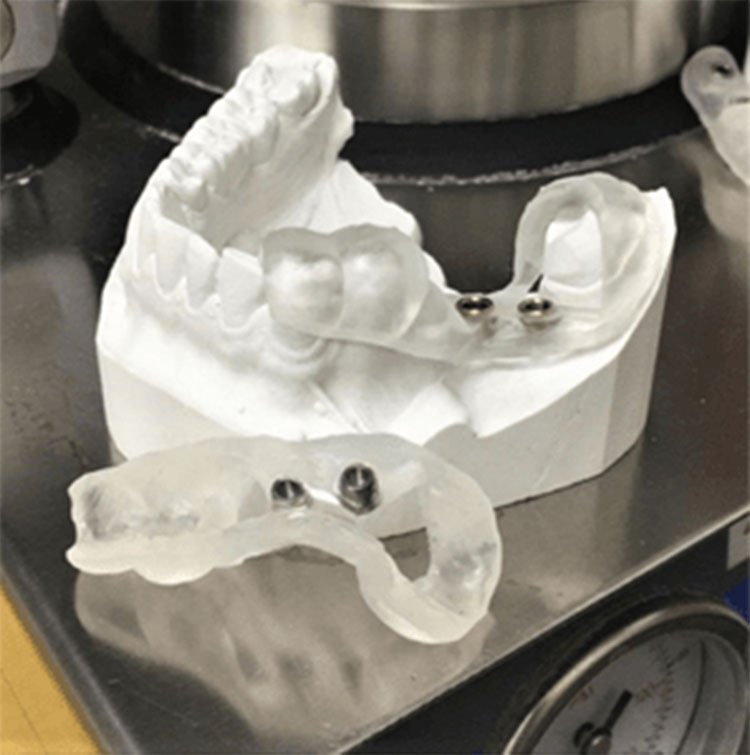 Фотополимерная смола HARZ Labs Dental Clear Pro (1кг)