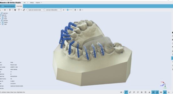 Программное обеспечение Maestro 3D Detal Studio | Ortho Studio