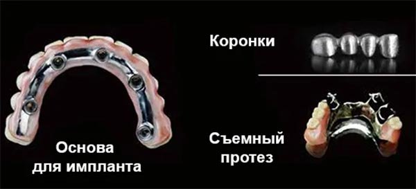 Стоматологический 3D принтер для печати имплантов