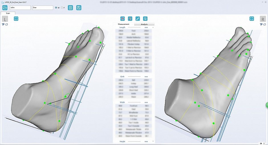 Ортопедический 3D сканер ScanPod3D UPOD-HD